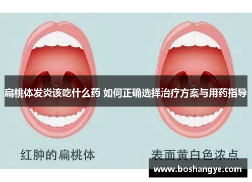 扁桃体发炎该吃什么药 如何正确选择治疗方案与用药指导