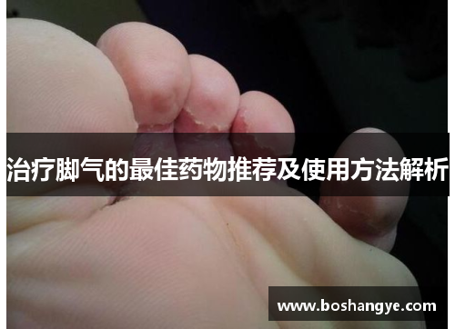 治疗脚气的最佳药物推荐及使用方法解析