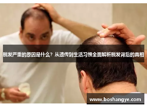 脱发严重的原因是什么？从遗传到生活习惯全面解析脱发背后的真相